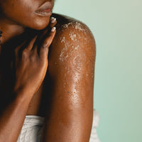 Person with visible skin condition on arm against a light green background
